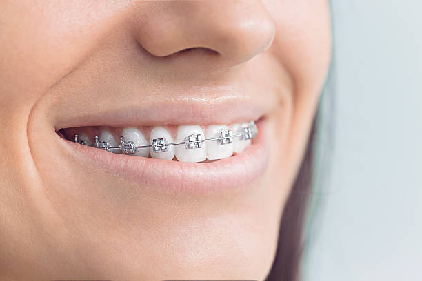 Best Invisalign and Clear Aligners  in Warson Woods, MO